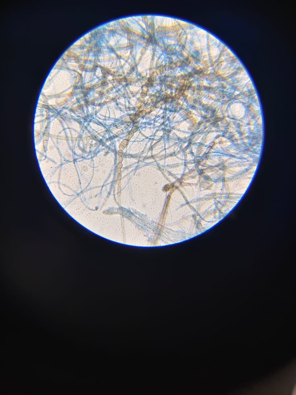 Detailed fungal hyphae structure visible through microscopy