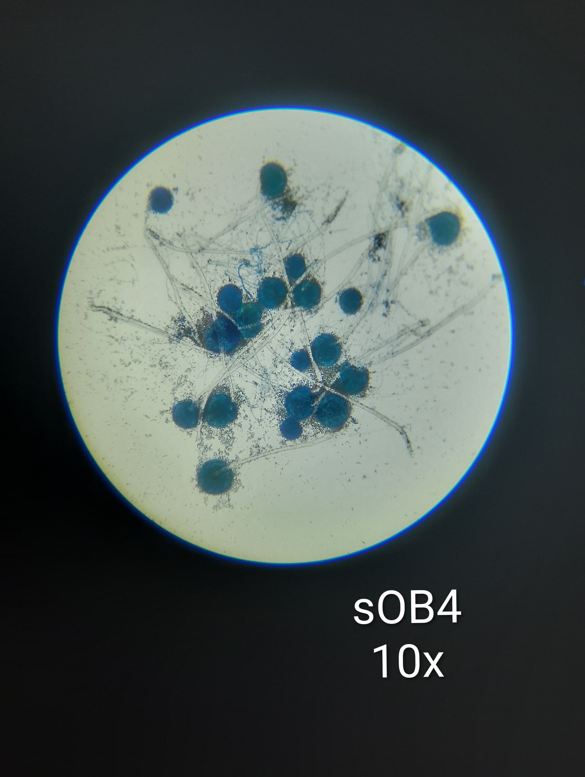 Microscopic view of fungal spores under 40x magnification