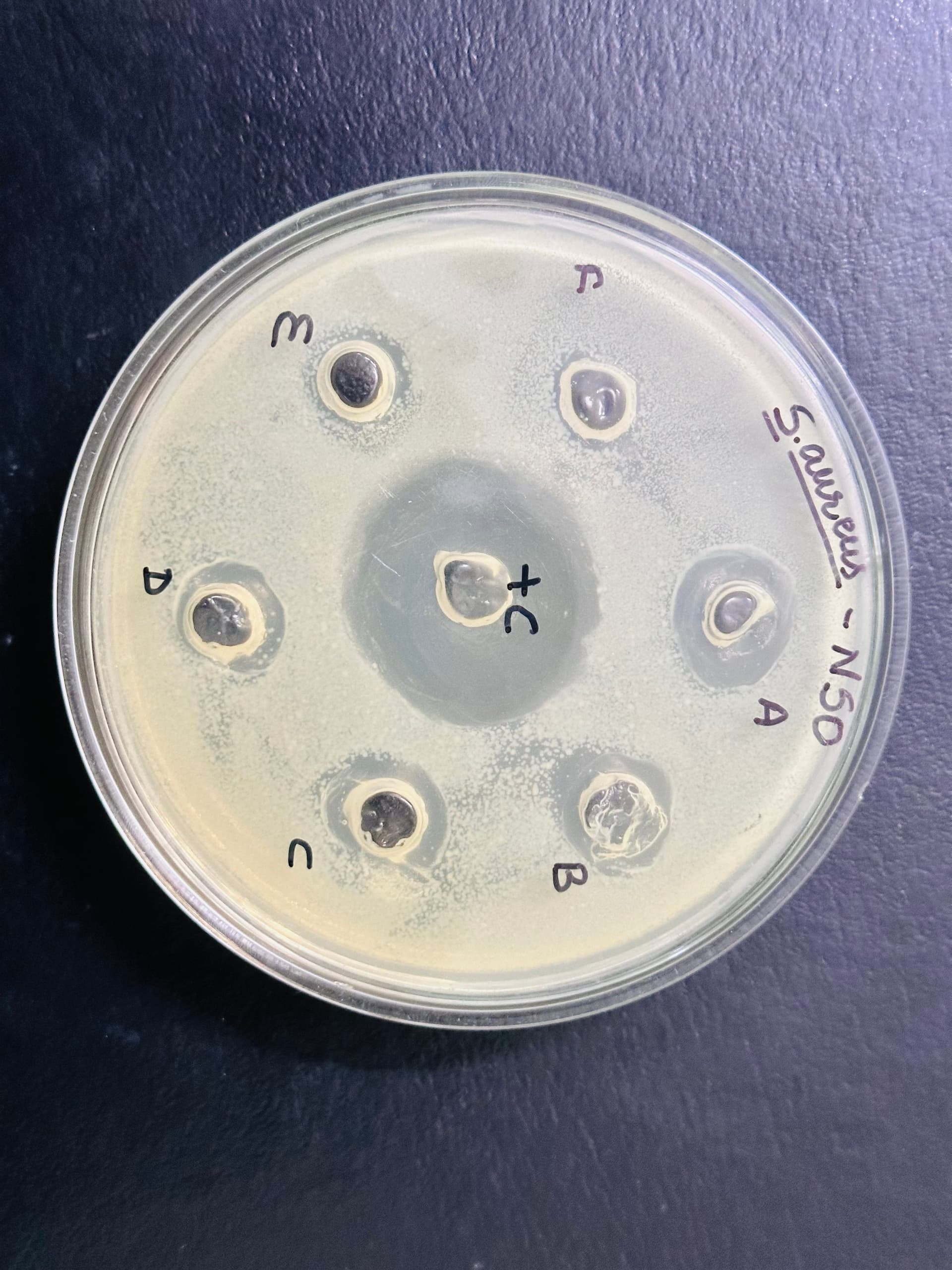 Zones of clearance on a bacterial agar plate