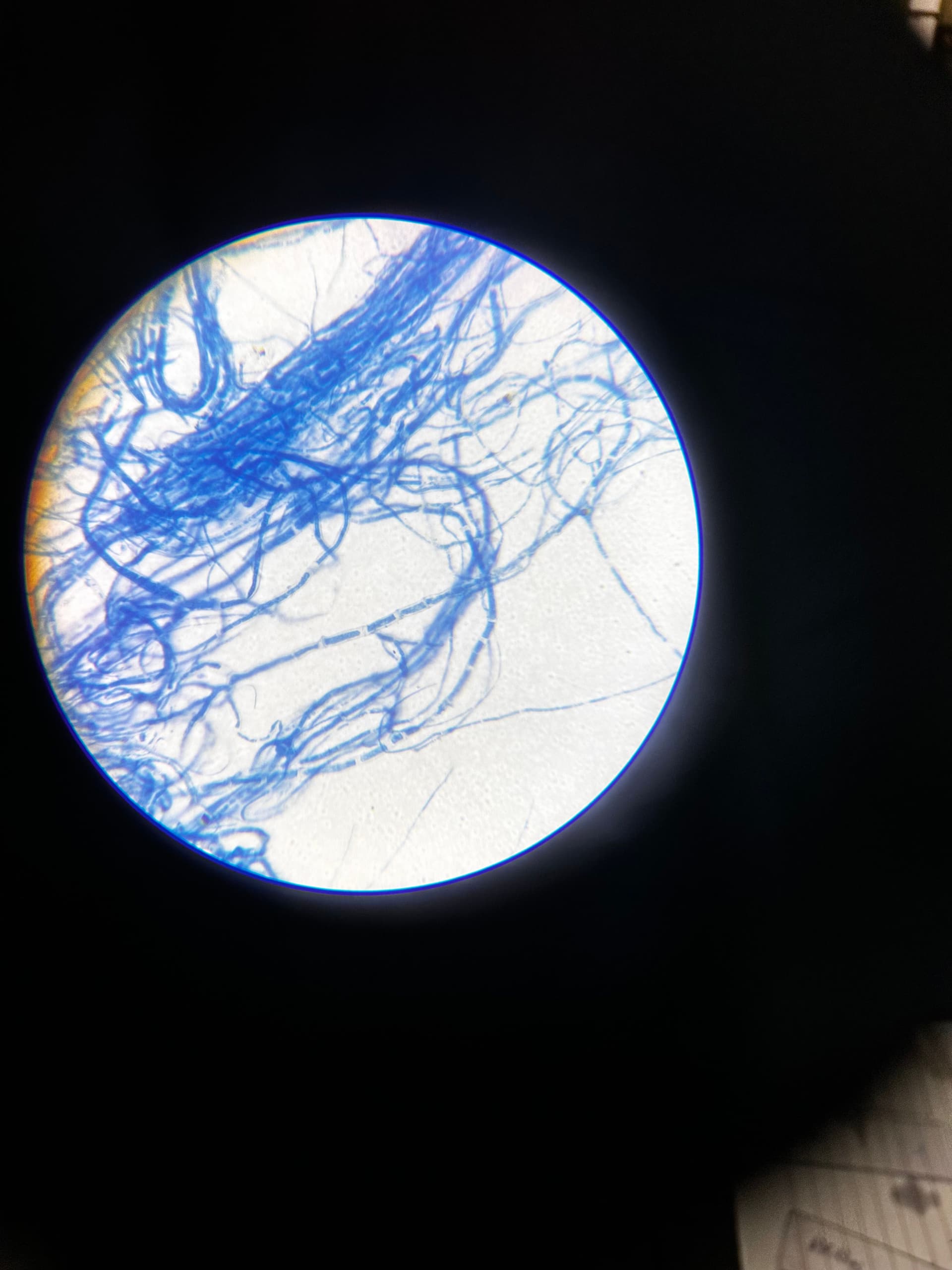 Dense network of fungal mycelium under the microscope